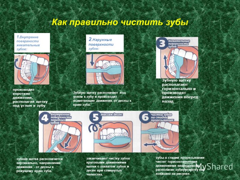 Как правильно почистить. Как правильно чистить зубы. Правильная чистка зубов. Памятка как правильно чистить зубы. Памятка правильная чистка зубов.