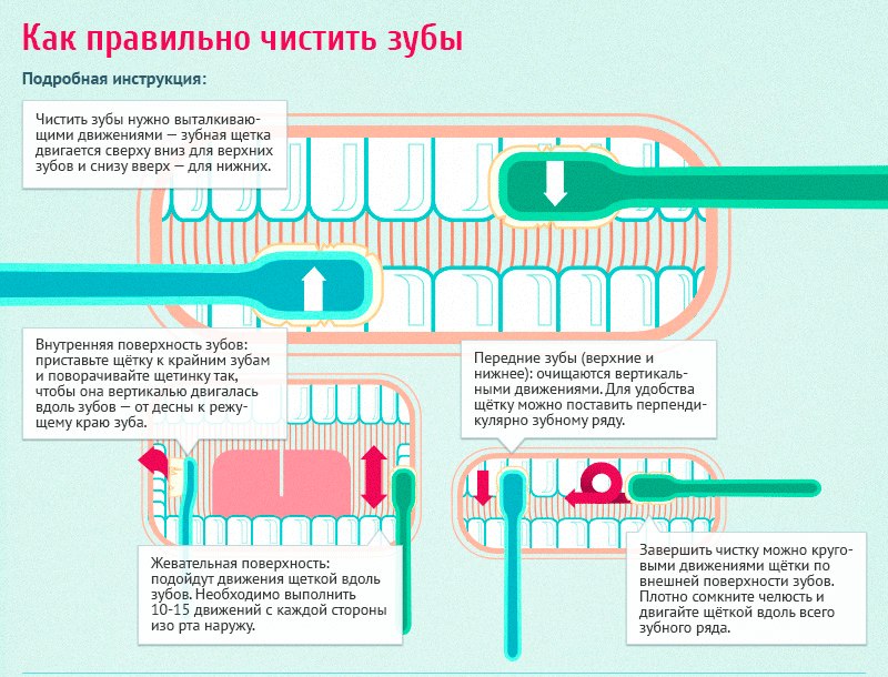 Схема чистки зубов