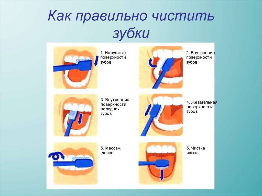 Когда лучше чистить зубы. Как правильно чистить зубы. Как правильно читать зубы. Правильность чистки зубов. Схема чистки зубов.
