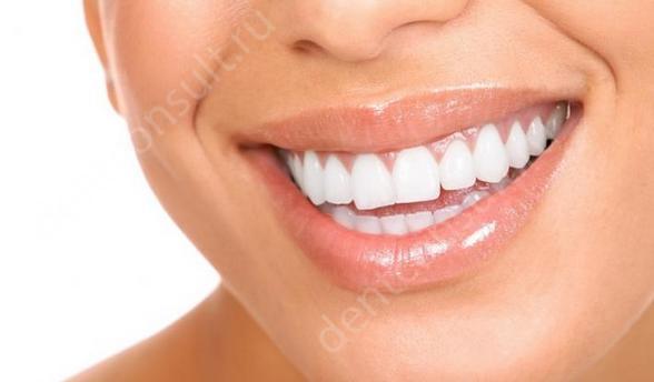 Белые, красивые зубы