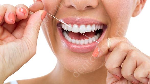 Фото: Зубная нить (флосс) — специальная нитка для очистки межзубных промежутков. 
