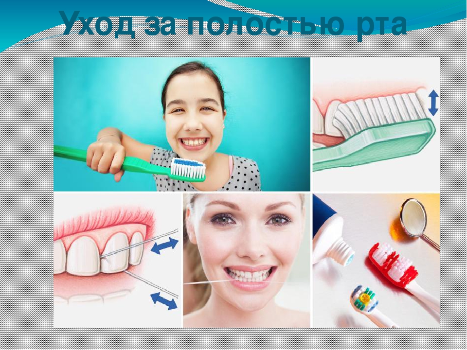 Проводить гигиену полости рта необходимо. Гигиена зубов. Зубы гигиена полости рта. Индивидуальная гигиена полости рта. Профилактика чистки зубов.