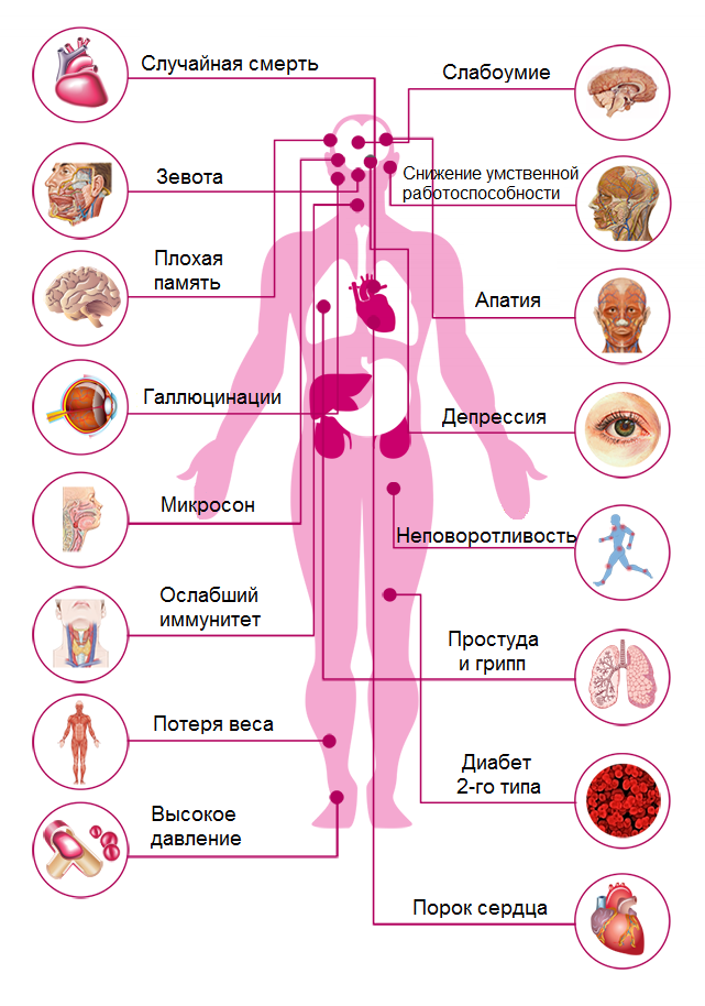 К каким заболеваниям приводит недосып