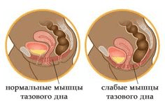 Интимные мышцы и вумбилдинг